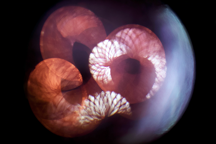 Signs of PCOS and Fatty Liver: How Insulin Resistance Affects Both and What to Do About It